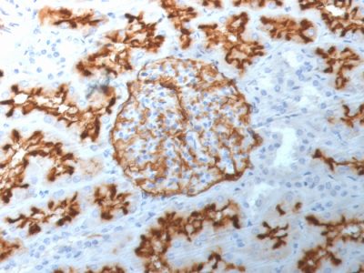 CD10 Monoclonal Mouse Antibody (MME/1892)