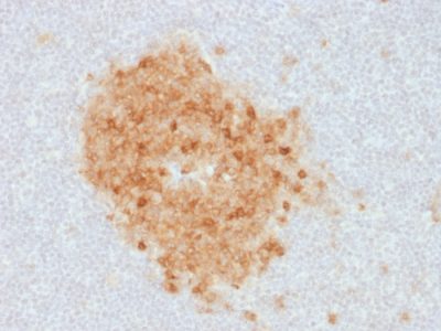 CD10 Monoclonal Mouse Antibody (MME/1893)