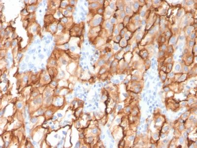CD10 Monoclonal Mouse Antibody (MME/2579)