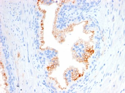 CD10 Monoclonal Mouse Antibody (MME/2580)