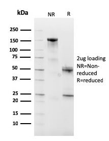 CD10 Monoclonal Mouse Antibody (MME/2590)