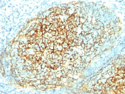 CD106 / VCAM-1 Monoclonal Mouse Antibody (1.4C3)