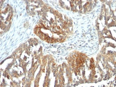 CD106 / VCAM-1 Monoclonal Mouse Antibody (B-K9)