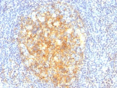 CD106 / VCAM-1 Monoclonal Mouse Antibody (VCAM1/843)