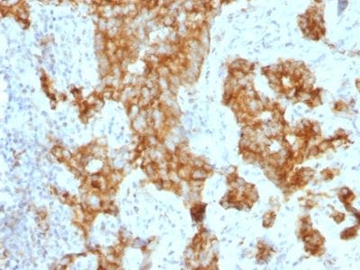 CD11c Monoclonal Mouse Antibody (ITGAX/1243)
