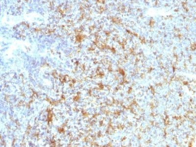 CD11c Monoclonal Mouse Antibody (ITGAX/1243)