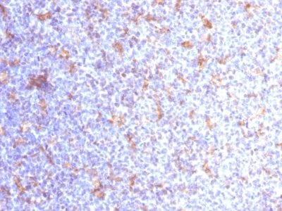 CD11c Monoclonal Mouse Antibody (ITGAX/1284)