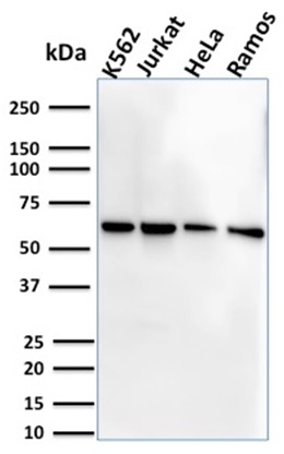CD127 / IL7R Monoclonal Mouse Antibody (IL7R/2751)