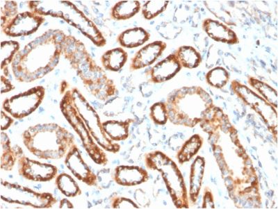 CD137 / 4-1BB / TNFRSF9 Monoclonal Mouse Antibody (4-1BB/3201)