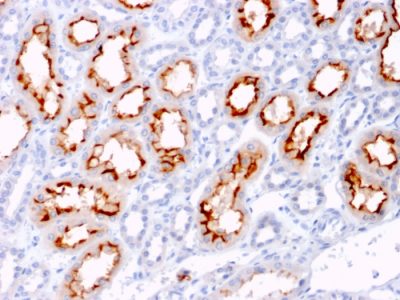 CD137L / 4-1BBL / TNFSF9 Monoclonal Mouse Antibody (CD137L/1547)