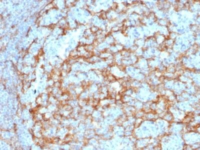 CD14 Monoclonal Mouse Antibody (LPSR/2385)