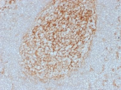 CD14 Monoclonal Mouse Antibody (LPSR/2385)