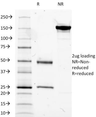 CD14 Monoclonal Mouse Antibody (LPSR/2385)