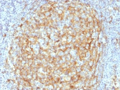 CD14 Monoclonal Mouse Antibody (LPSR/2386)