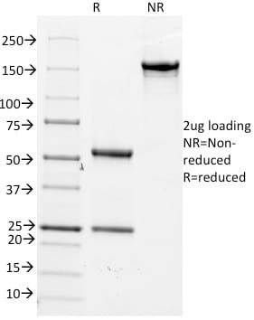 CD14 Monoclonal Mouse Antibody (LPSR/2386)