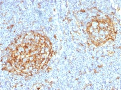 CD14 Monoclonal Mouse Antibody (LPSR/2397)