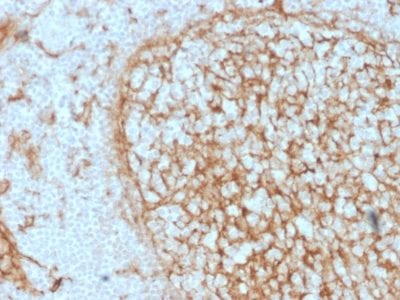 CD14 Monoclonal Mouse Antibody (LPSR/2397)
