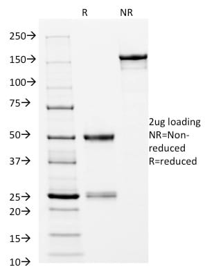 CD14 Monoclonal Mouse Antibody (LPSR/2397)