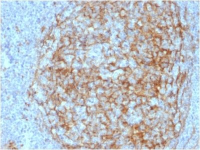 CD14 Monoclonal Mouse Antibody (LPSR/2408)