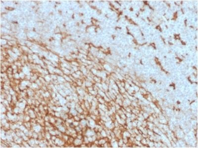 CD14 Monoclonal Mouse Antibody (LPSR/2408)