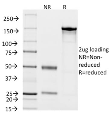 CD14 Monoclonal Mouse Antibody (LPSR/2408)