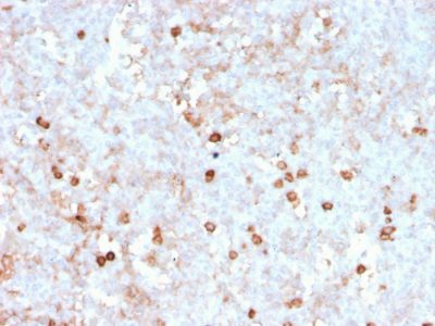 CD14 Recombinant Monoclonal Mouse Antibody (rLPSR/2408)