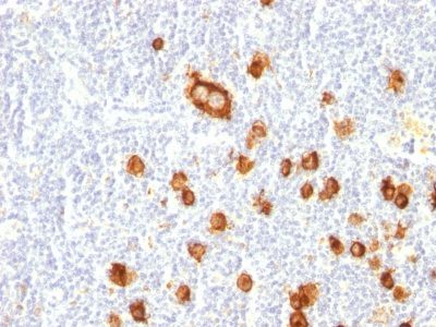 CD15 / FUT4 / Lewis-X Monoclonal Mouse Antibody (FUT4/815)