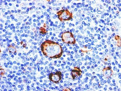 CD15 / FUT4 / Lewis-X Monoclonal Mouse Antibody (Leu-M1)