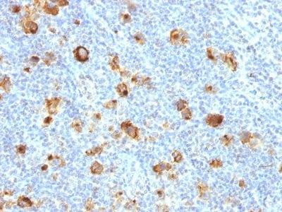CD15 / FUT4 / Lewis-X Recombinant Monoclonal Rabbit Antibody (FUT4/1478R)
