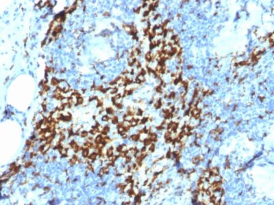 CD163 Monoclonal Mouse Antibody (M130/2164)