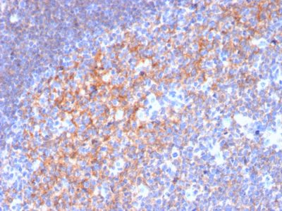 CD19 Monoclonal Mouse Antibody (CD19/3116)