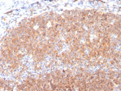CD19 Monoclonal Mouse Antibody (CD19/3117)