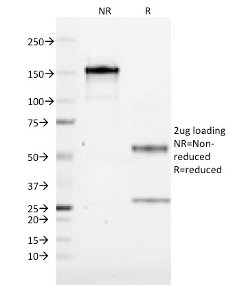 CD19 Monoclonal Mouse Antibody (CVID3/155)