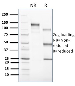 CD1c Monoclonal Mouse Antibody (CD1C/1603)