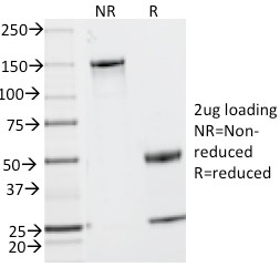 CD2 Monoclonal Mouse Antibody (UMCD2)