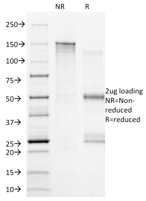 CD20 Monoclonal Mouse Antibody (B9E9)