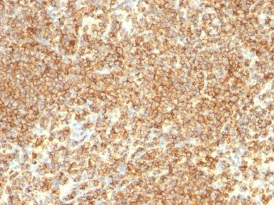CD20 Monoclonal Mouse Antibody (IGEL/773)