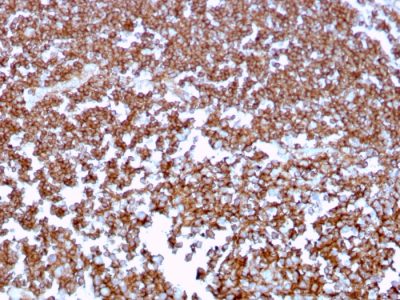 CD20 Monoclonal Mouse Antibody (MS4A1/3409)