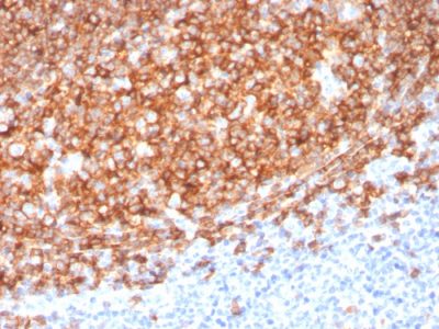 CD20 Monoclonal Mouse Antibody (MS4A1/3410)