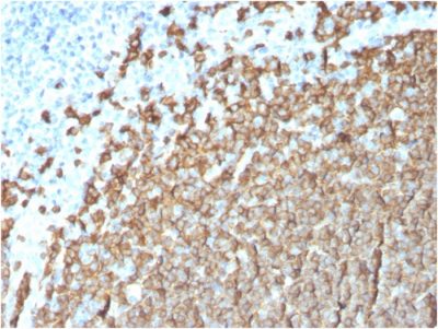 CD20 Monoclonal Mouse Antibody (MS4A1/3411)