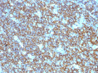 CD20 Polyclonal Rabbit Antibody
