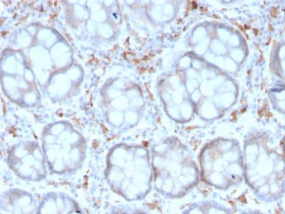CD209 / DC-SIGN Recombinant Monoclonal Mouse Antibody (rC209/1781)