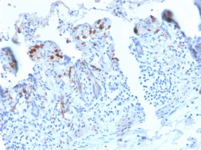 CD209 / DC-SIGN Recombinant Monoclonal Rabbit Antibody (C209/2749R)