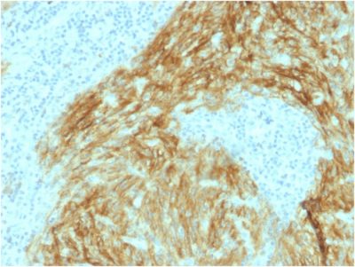 CD21 Monoclonal Mouse Antibody (CR2/1952)