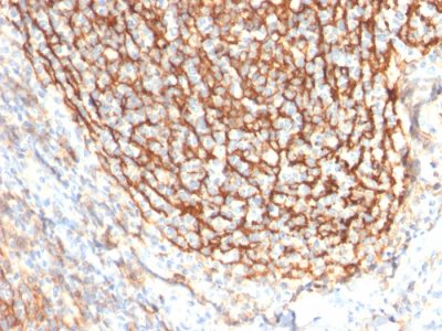 CD21 Monoclonal Mouse Antibody (CR2/2754)
