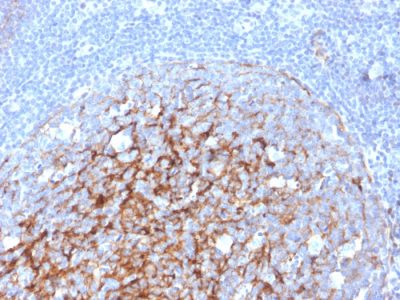 CD21 Monoclonal Mouse Antibody (CR2/3247)