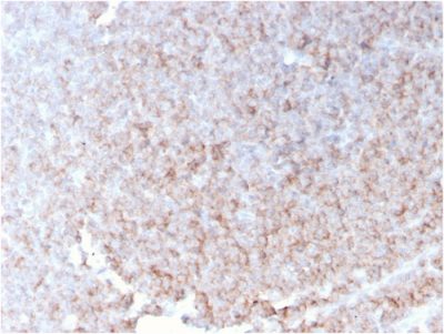 CD21 Recombinant Monoclonal Mouse Antibody (rCR2/1952)