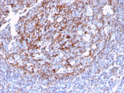 CD21 Recombinant Monoclonal Rabbit Antibody (CR2/3124R)
