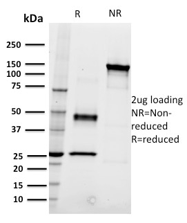 CD22 / BL-CAM Monoclonal Mouse Antibody (RFB4)