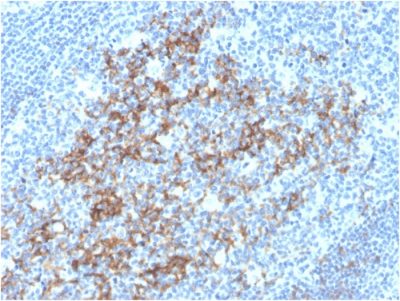 CD23 Monoclonal Mouse Antibody (FCER2/3592)